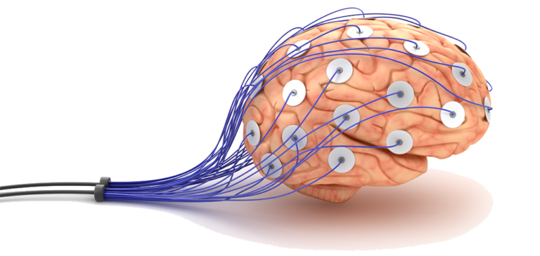 brain-with-electrodes | Saint Louis Neurotherapy